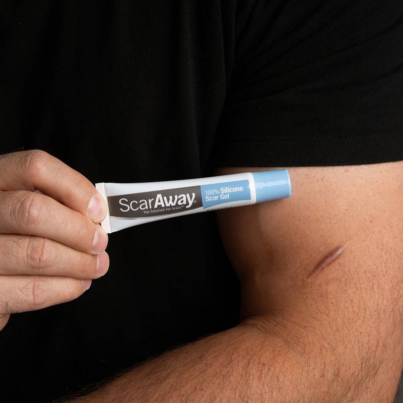 ScarAway Scar Treatment Gel - .35oz
