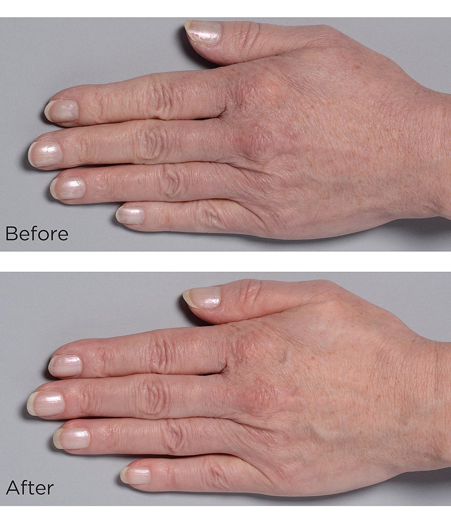 Perricone MD Cold Plasma Plus Hand Therapy