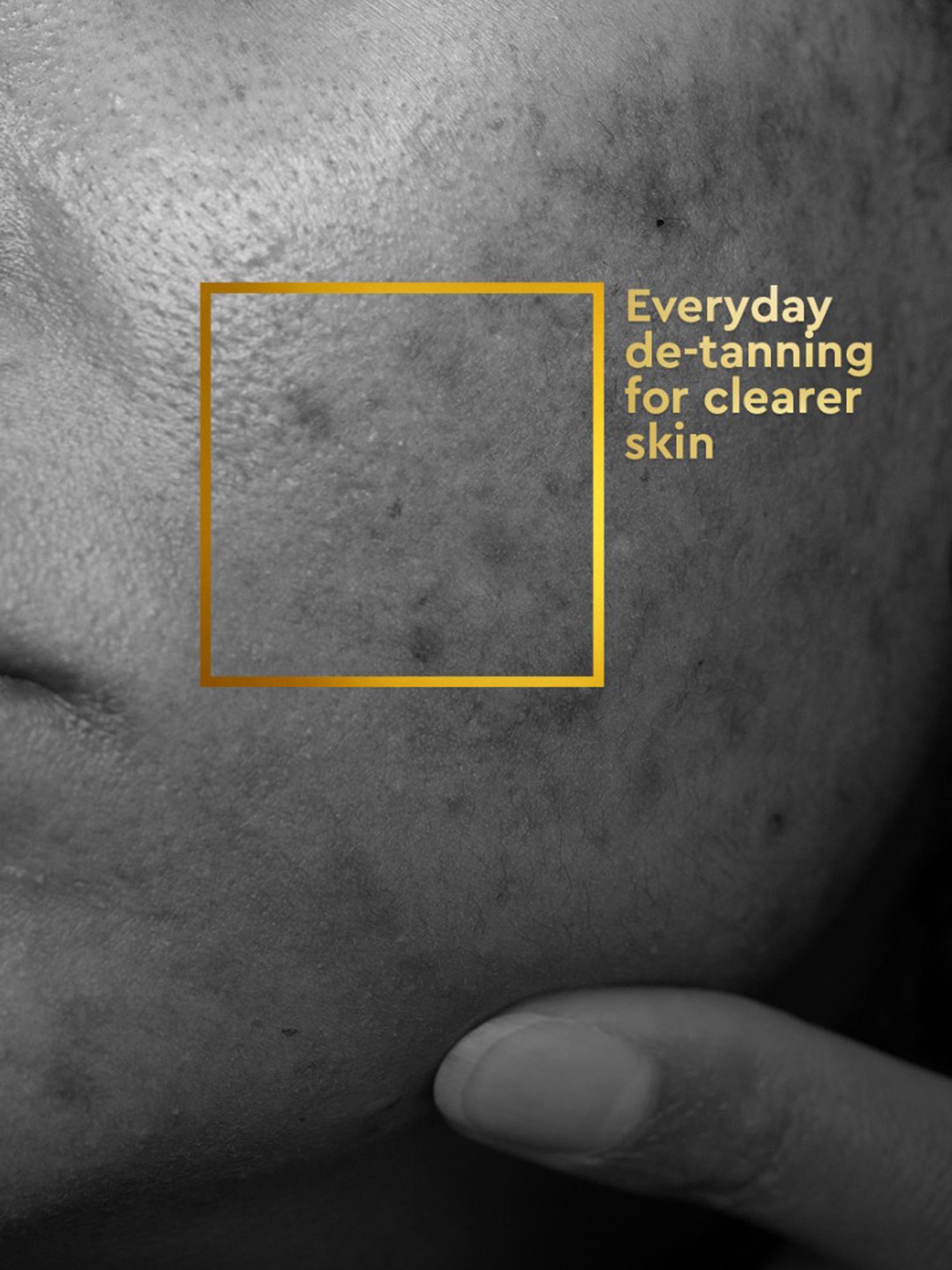 VLCC Clinic Skin Clarifying De-Tan Face Wash - 150 ml