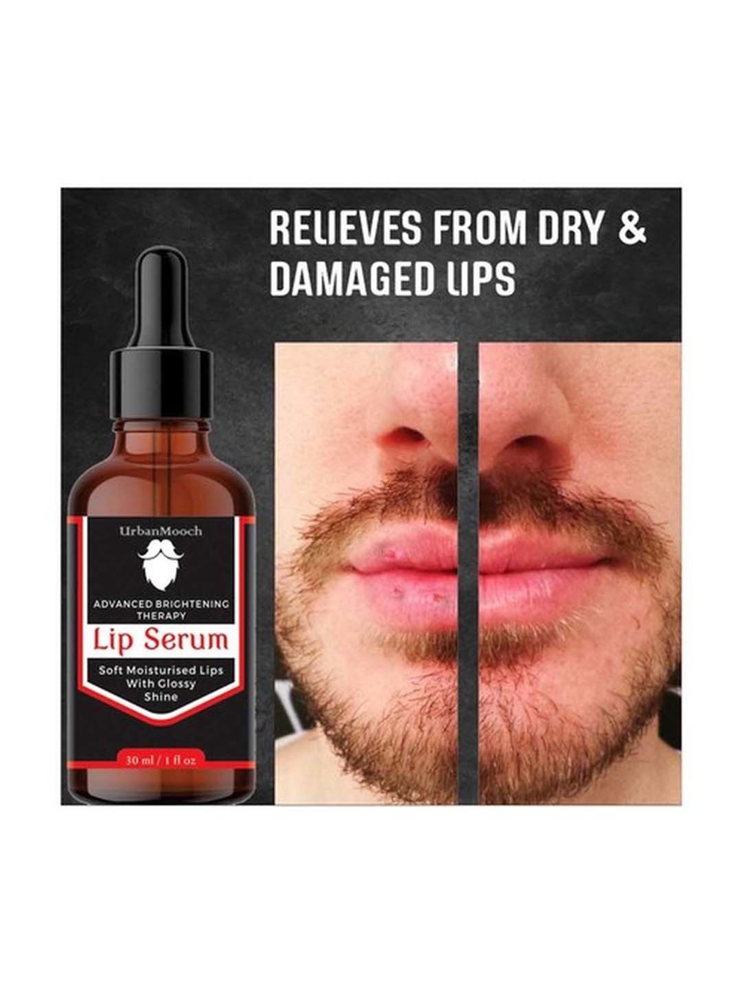UrbanMooch Advance Brightning Lip Serum - 30 ml