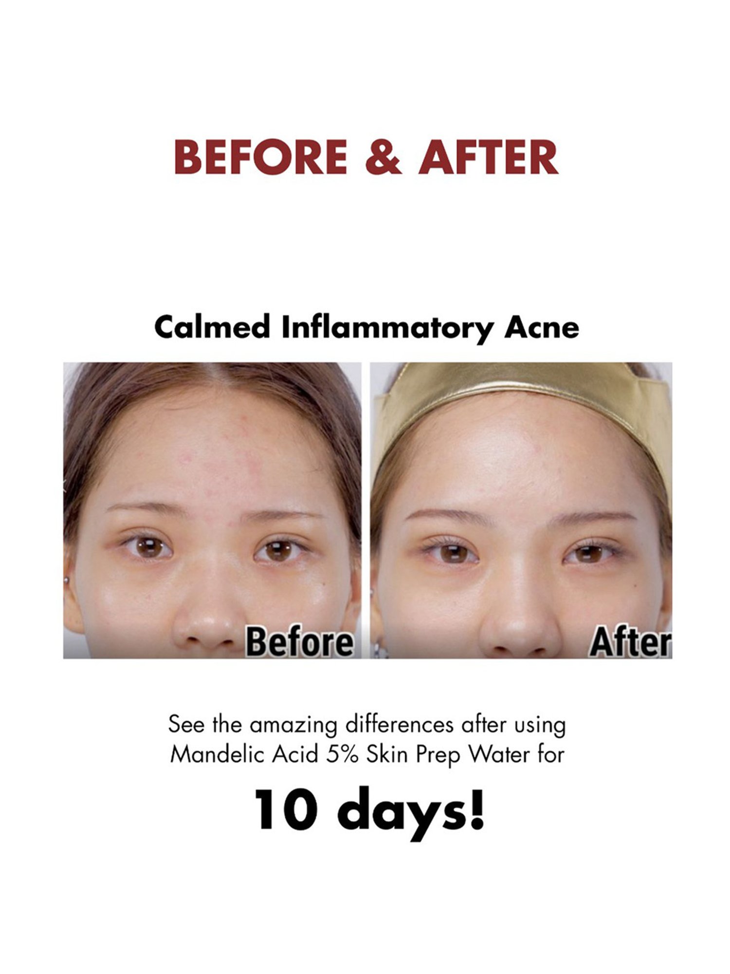 By Wishtrend Mandelic Acid 5% Skin Prep Water - 120 ml