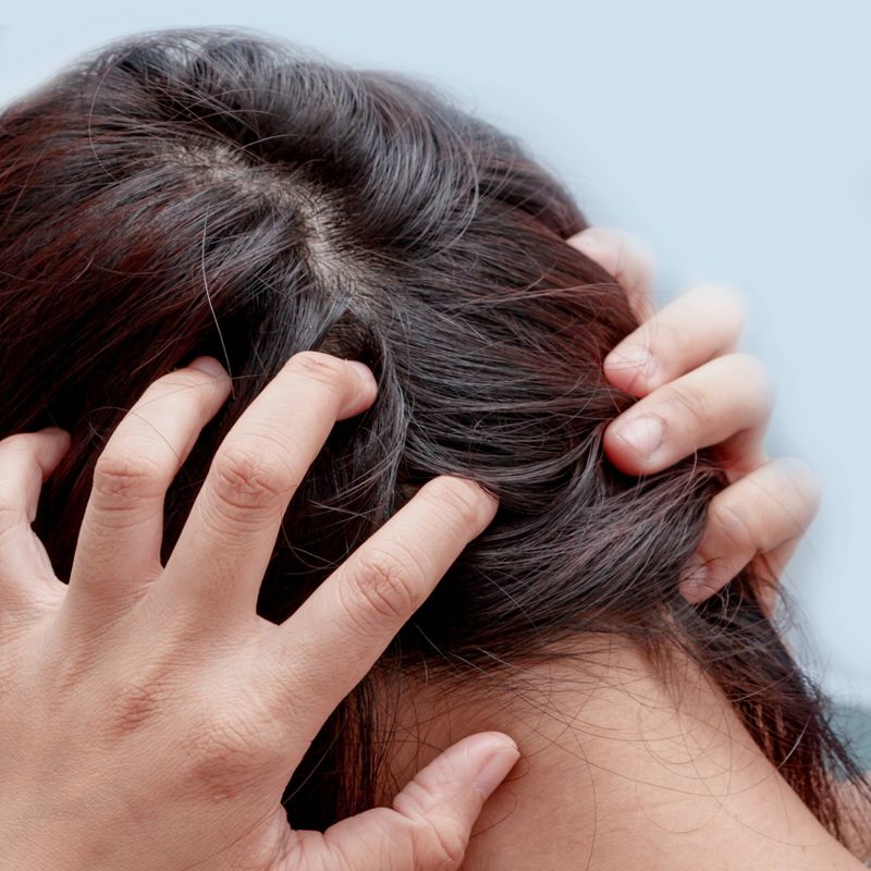 Neutrogena T/Gel Extra Strength Therapeutic Shampoo - 6 fl oz  177ml