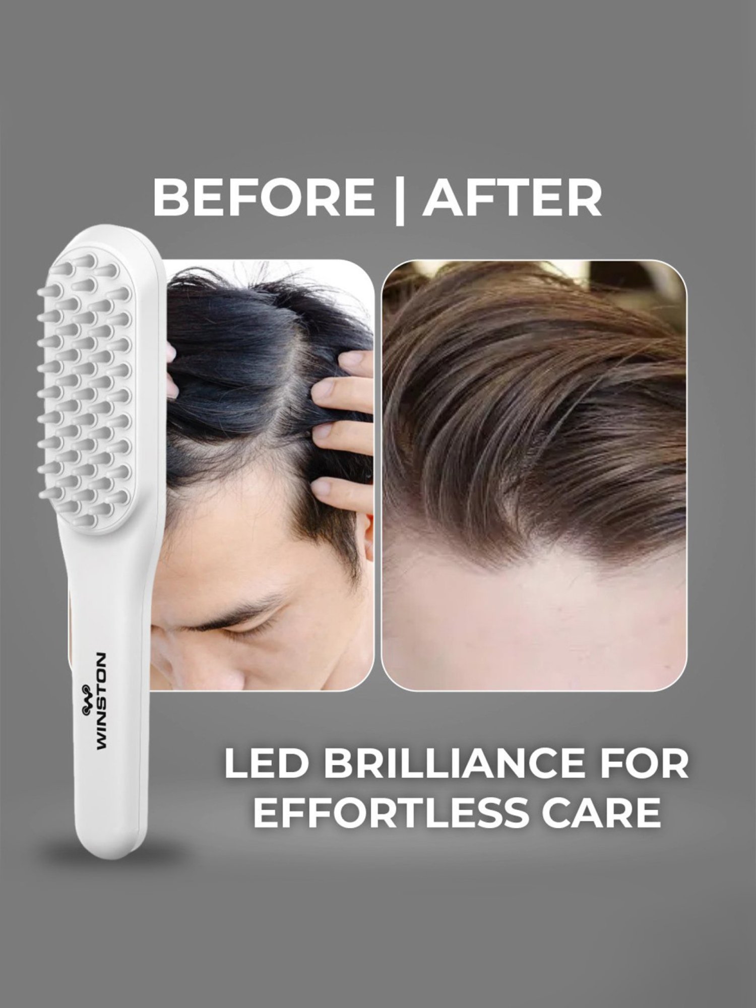 Winston Rechargeable Led Comb for Hair Growth, Vibration Scalp Massage - White