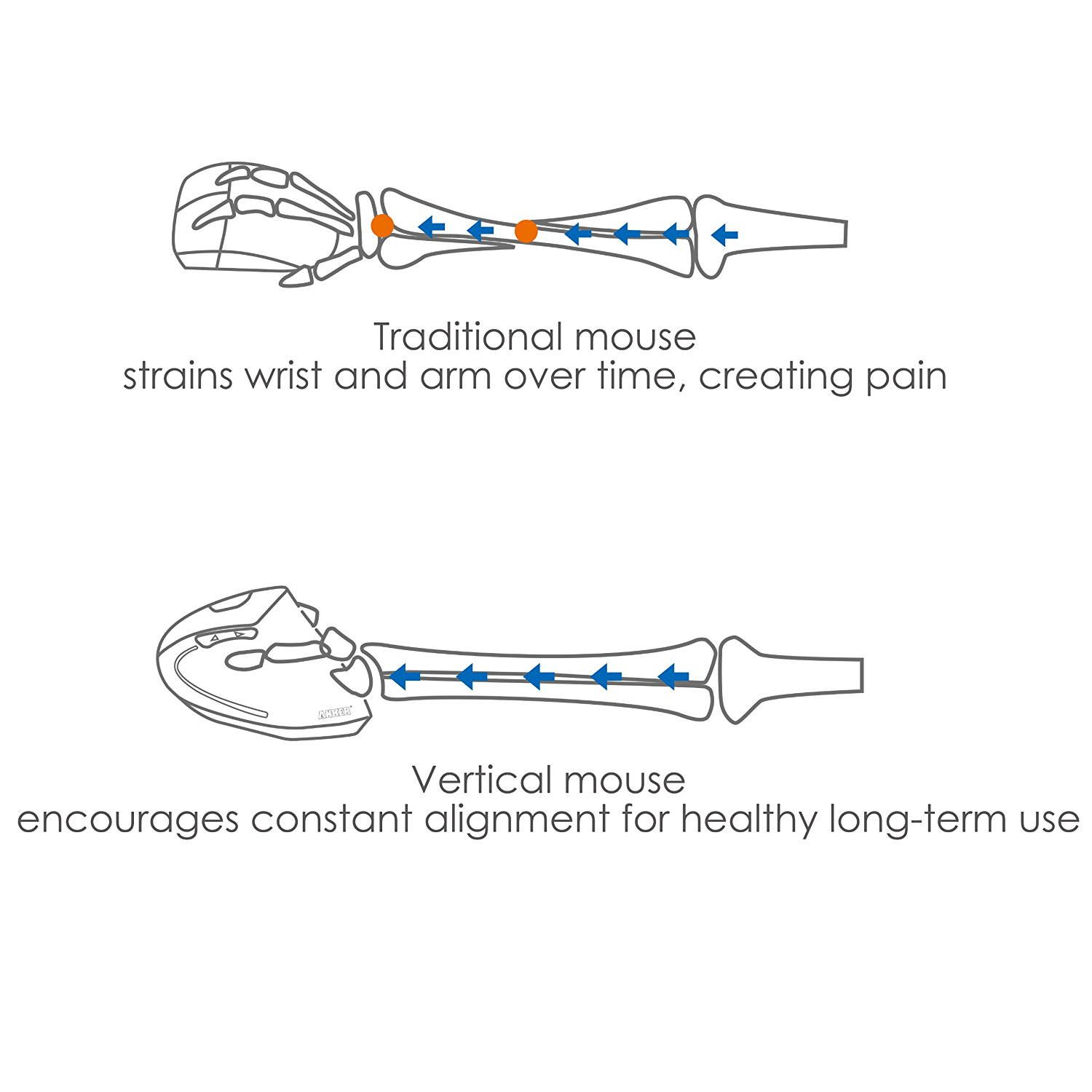 Anker Ergonomic Optical USB Wired Vertical Mouse 1000/1600 DPI, 5 Buttons, High Performance Ergonomic Optical USB Wired Vertical Mouse 1000/1600 DPI, 5 Buttons Ergonomic mice, Next/previous buttons