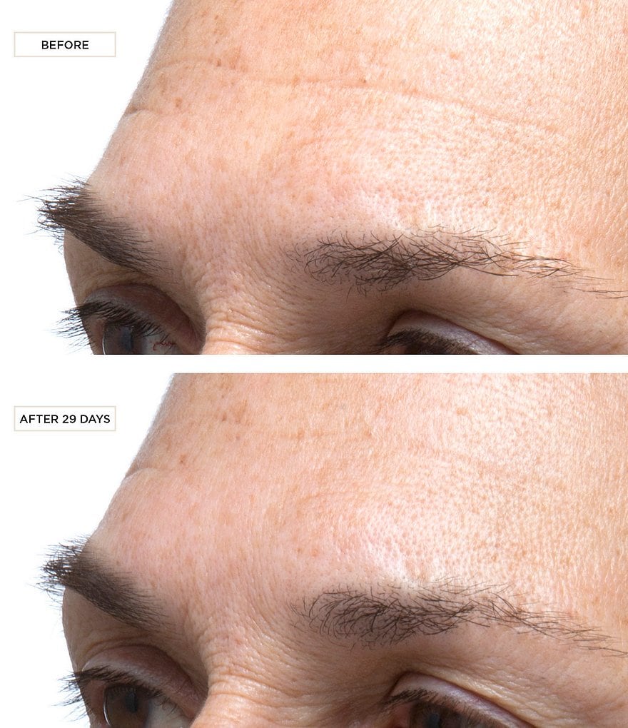 Perricone MD Cold Plasma Plus Face Jumbo Size Treatment