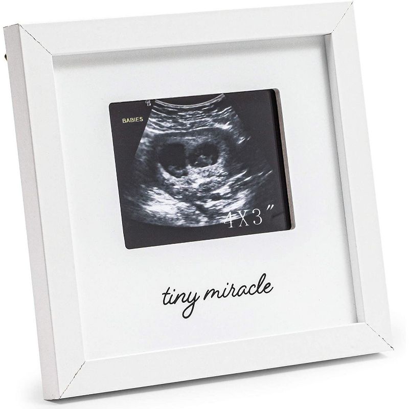 Juvale White Sonogram Keepsake PictureFrame for 4 x 3 Ultrasound Photos (7 x 6.5 Inches)