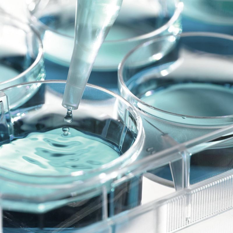 Olay KP Bump Body Scrub with Glycolic Acid and Vitamin B3 Complex - 4.5 fl.oz 