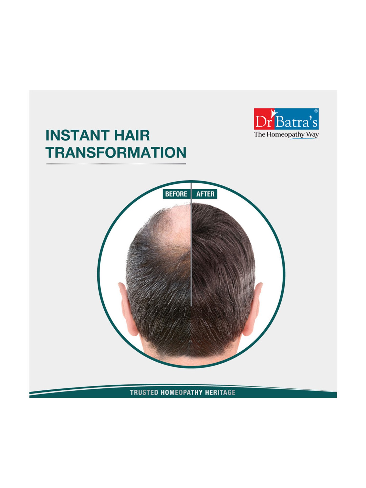 Dr. Batra's Instant Hair Natural Keratin Hair Building Fibre Dark Brown - 12 gm