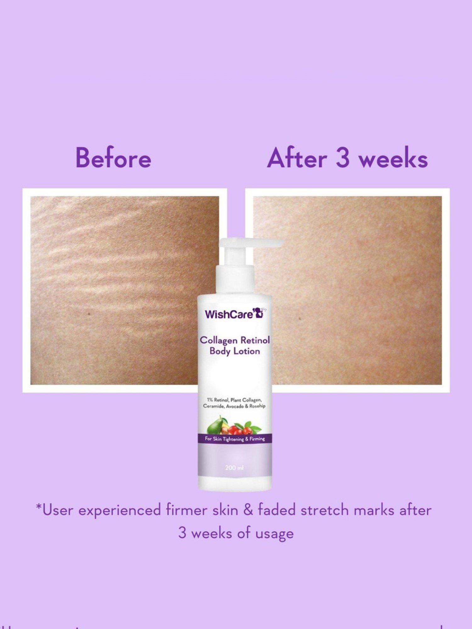 Wishcare Ceramide, Avocado & Rosehip Collagen Retinol Body Lotion - 200 ml