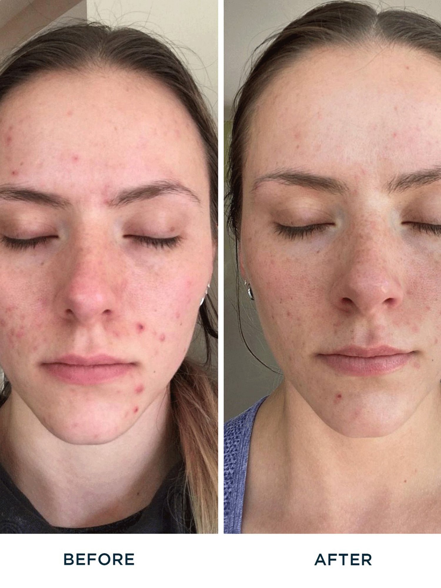 Lotus Herbals Illuminating Radiance Cleansing Foam - 100 gm