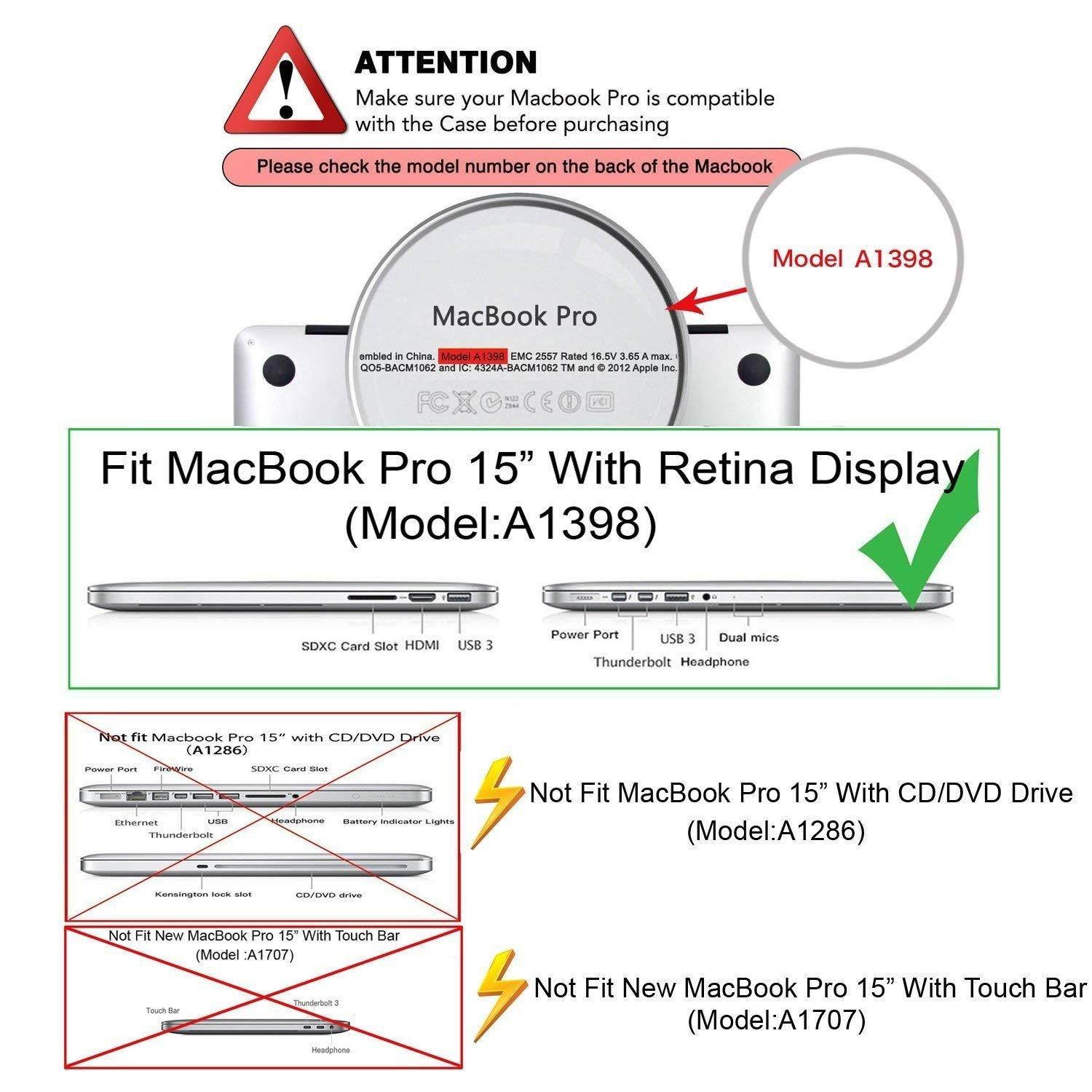 MOSISO Plastic Hard Case Shell & Keyboard Cover & Screen Protector Only Compatible [Previous Generation] MacBook Pro (No USB-C) Retina 15 Inch (Model: A1398) (No CD-ROM), Rose Quartz