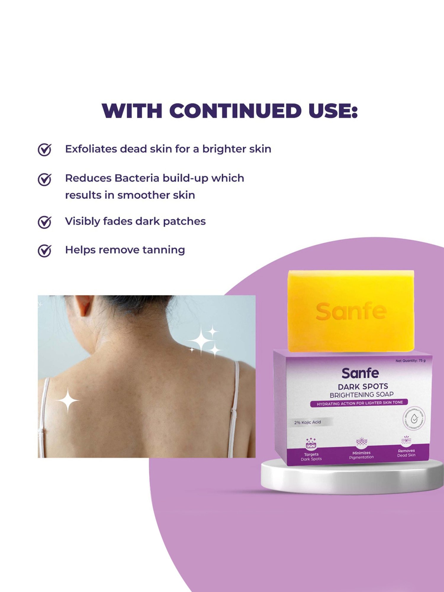 Sanfe 2% Kojic Acid Dark Spots Brightening Soap - 75 gm