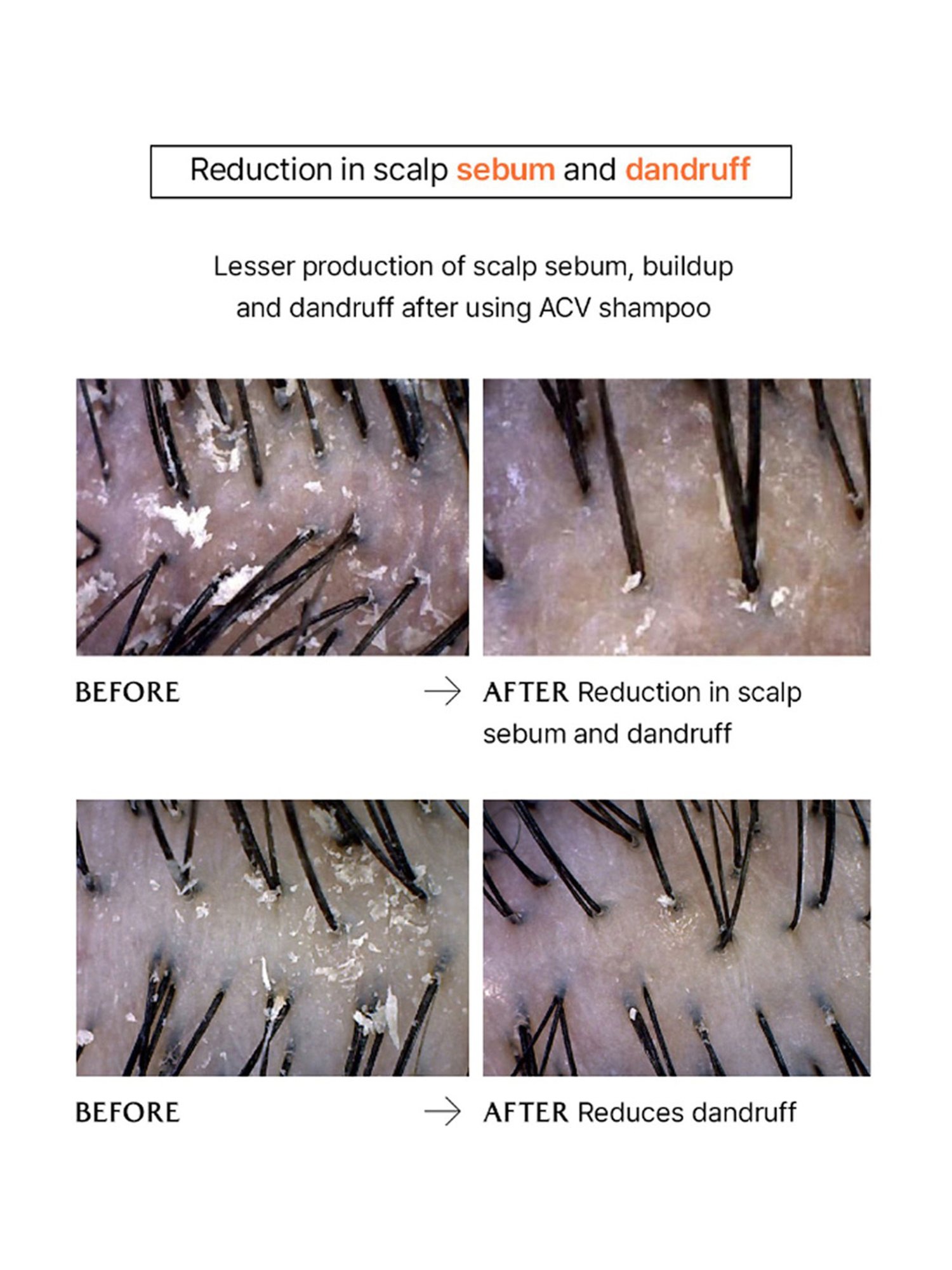 Lador A.C.V Vinegar Shampoo - 430 ml