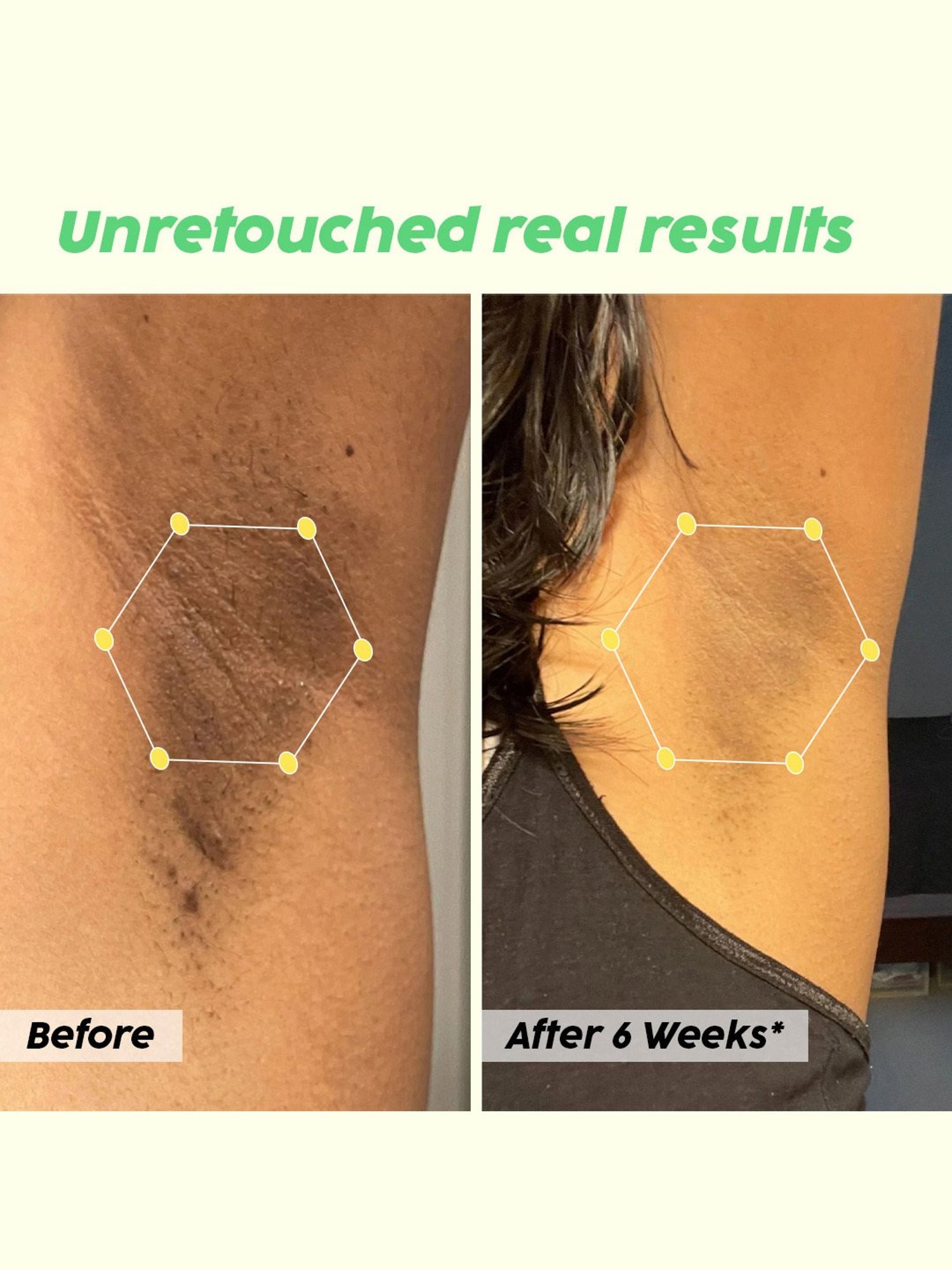 PLIX THE PLANT FIX Pineapple Underarm Polish Serum Spray - 100 ml