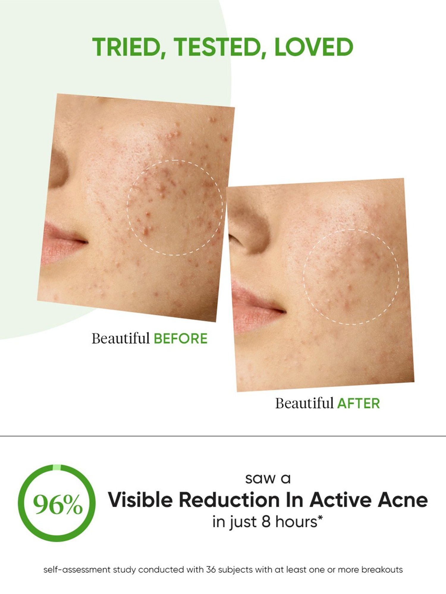 Kozimax Skin Lightening Cream - Pack of 2 (15 gm Each)