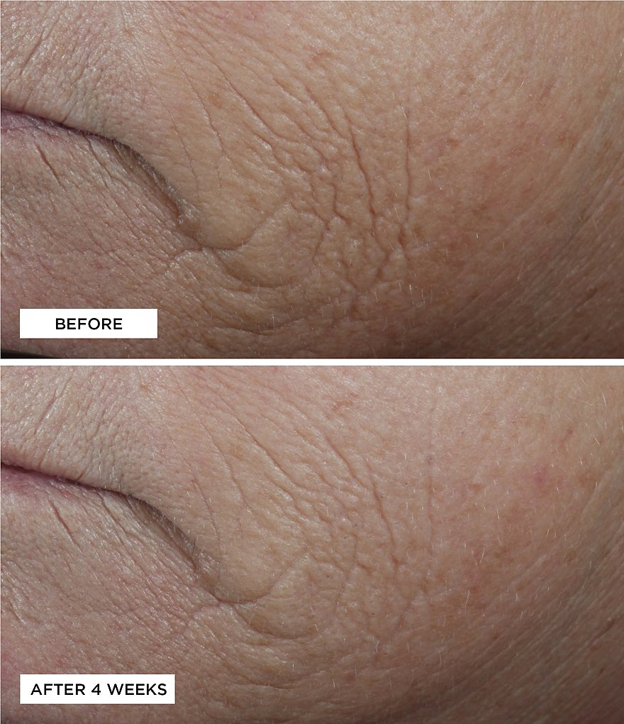 Perricone MD Neuropeptide Smoothing Facial Conformer