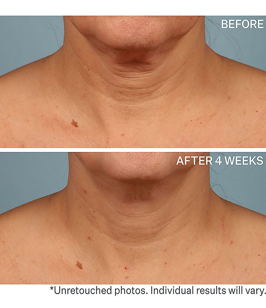 StriVectin TL ADVANCED&trade; Tightening Neck Cream Plus