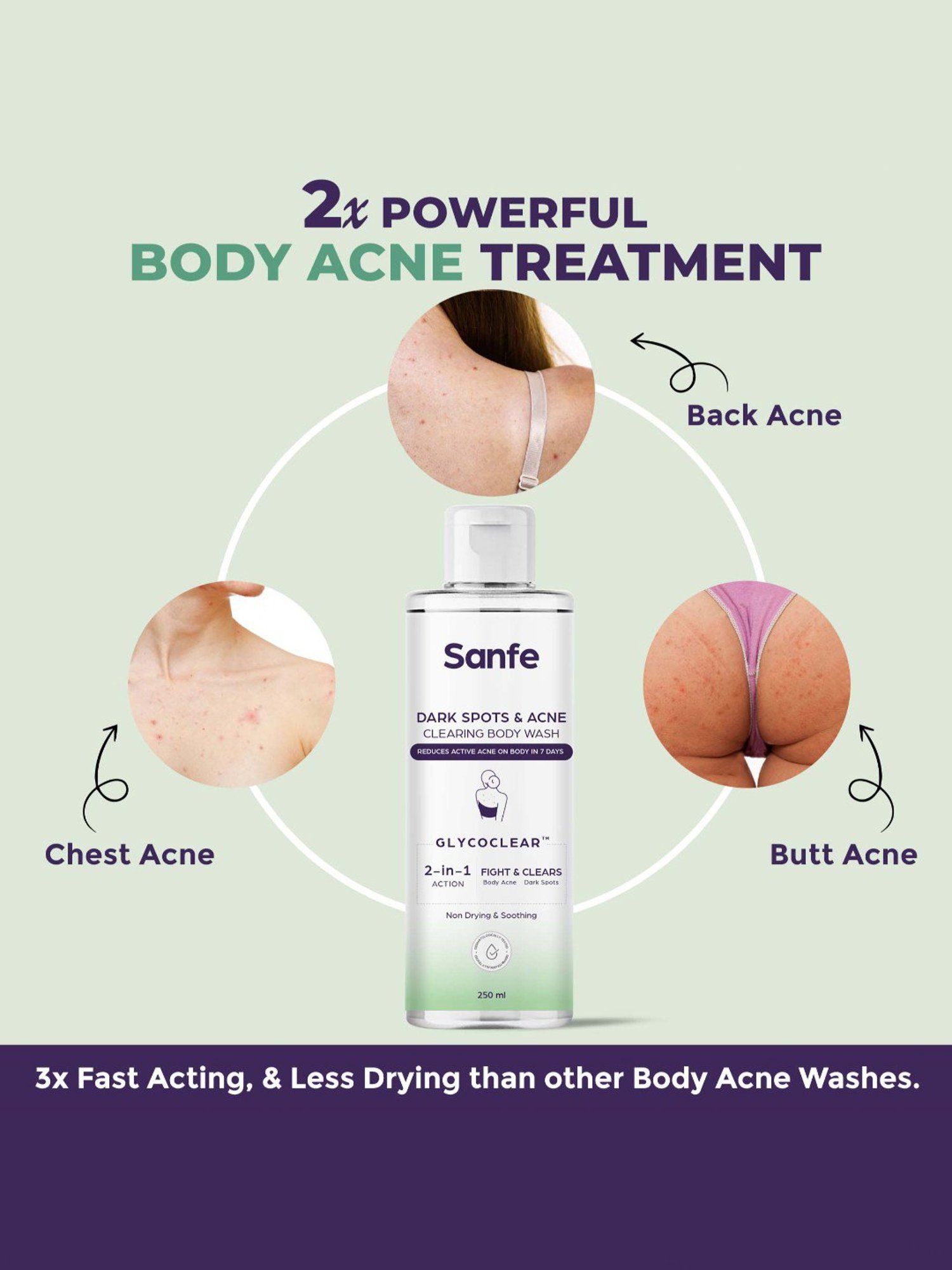 Sanfe Dark Spots & Acne Clearing Body Wash - 250 ml