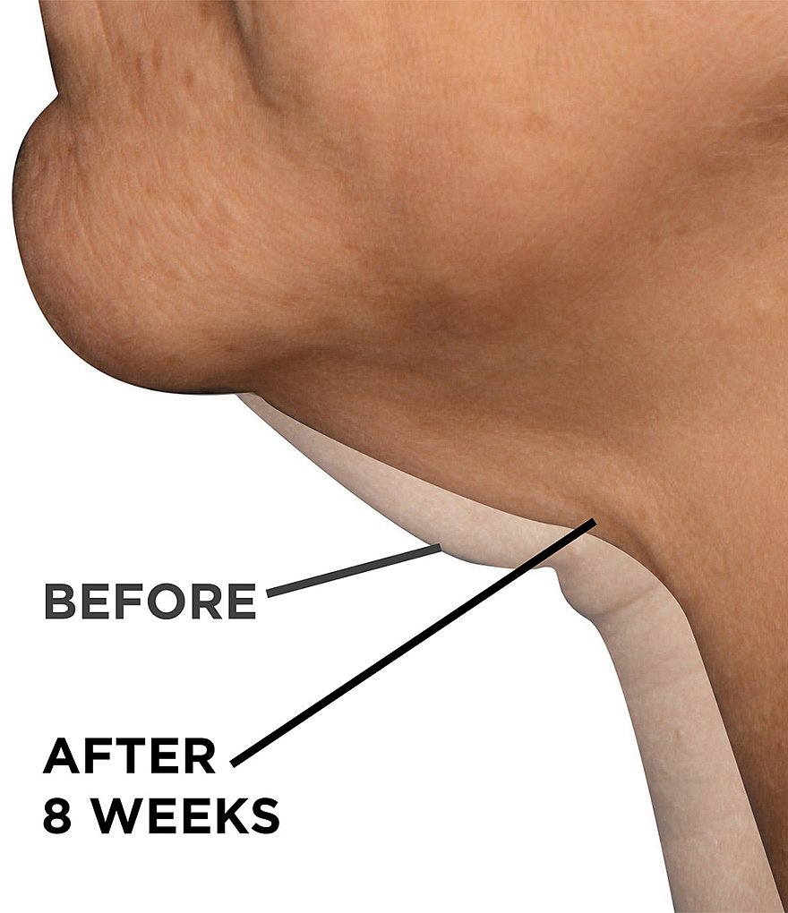 Dr. Brandt Needles No More Neck Sculpting Cream