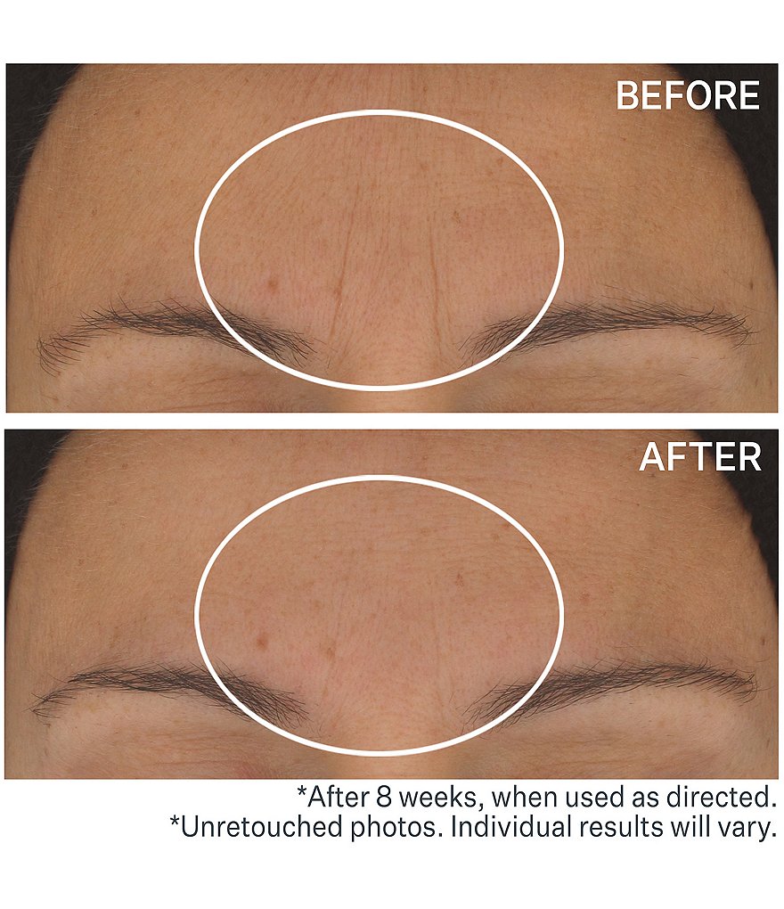 StriVectin S.T.A.R. LIGHT&trade; Retinol Night Oil