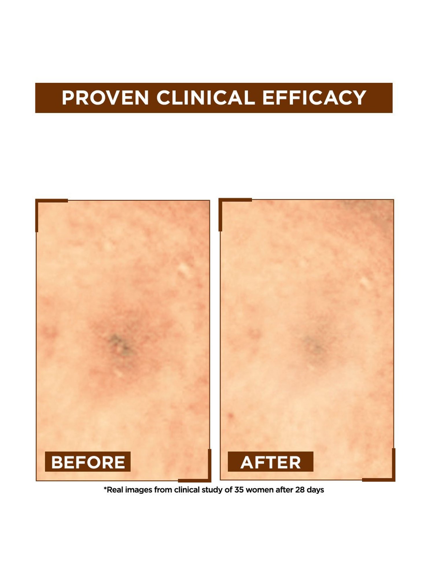 Khadi Essentials 20% Vitamin C Face Serum with Grapefruit for Toned & Bright Skin - 30 ml