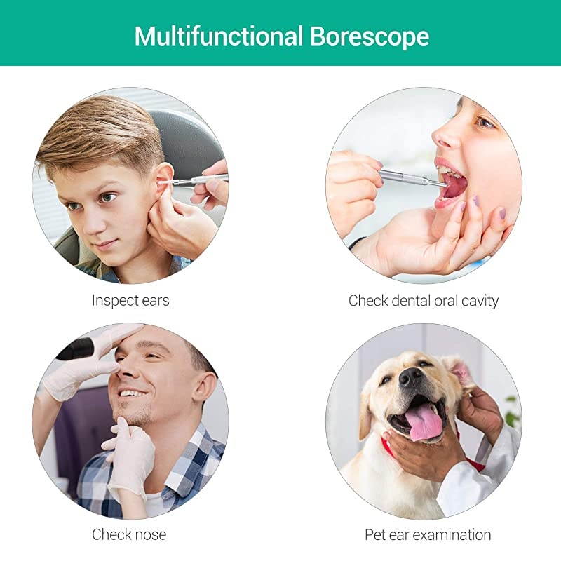 Otoscope Ear Endoscope  Digital 43mm HD Ear Scope with Earwax Removal WiFiUSB Ear Inspection Camera with 6 Adjustable LED Lights for iOS Android Mac Windows656Ft