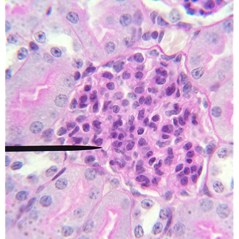 Microscope/Telescope Adapter for iPhone X