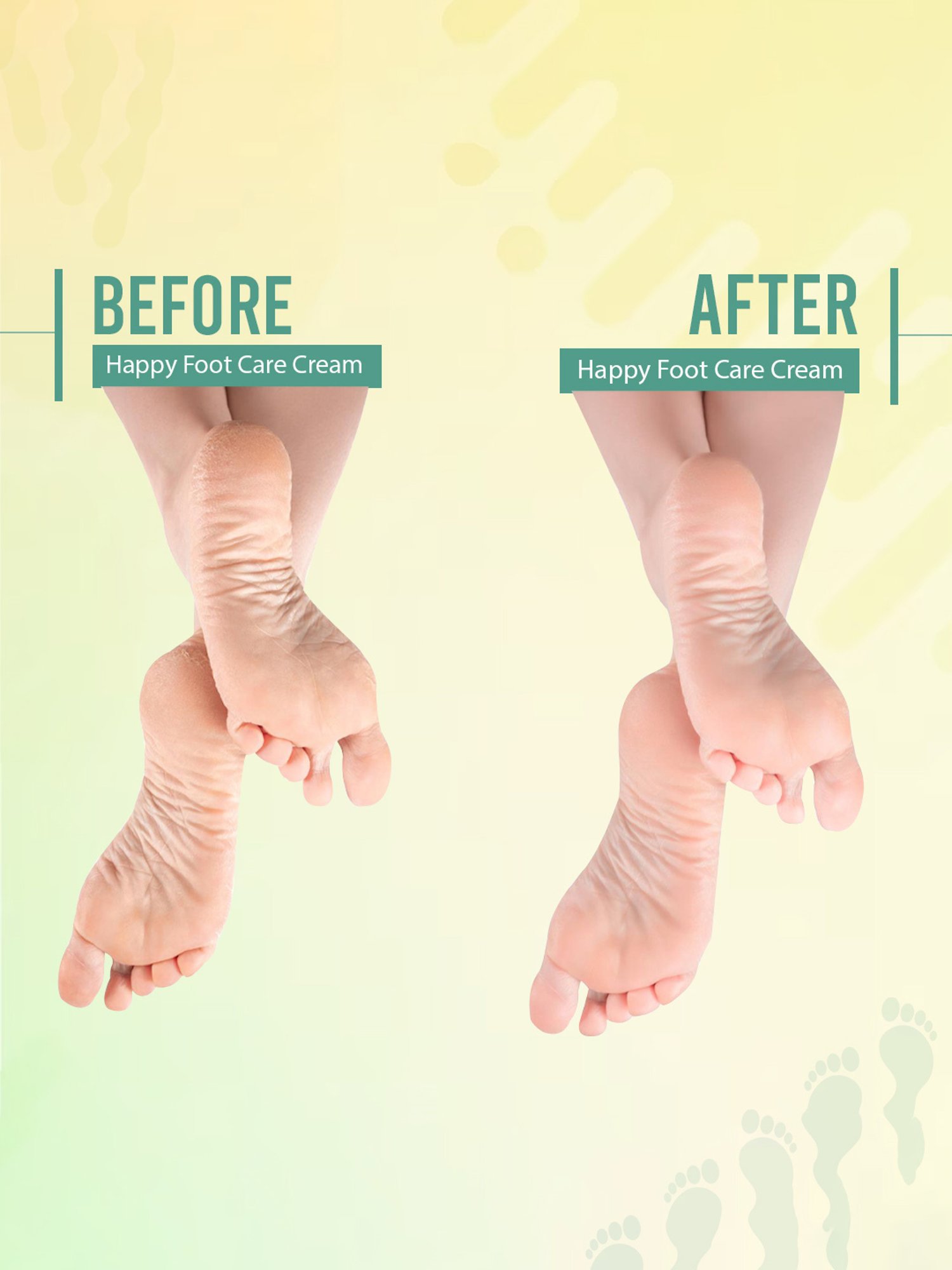 Glamveda Happy Foot Care Cream for Cracked Heels - 100 gm