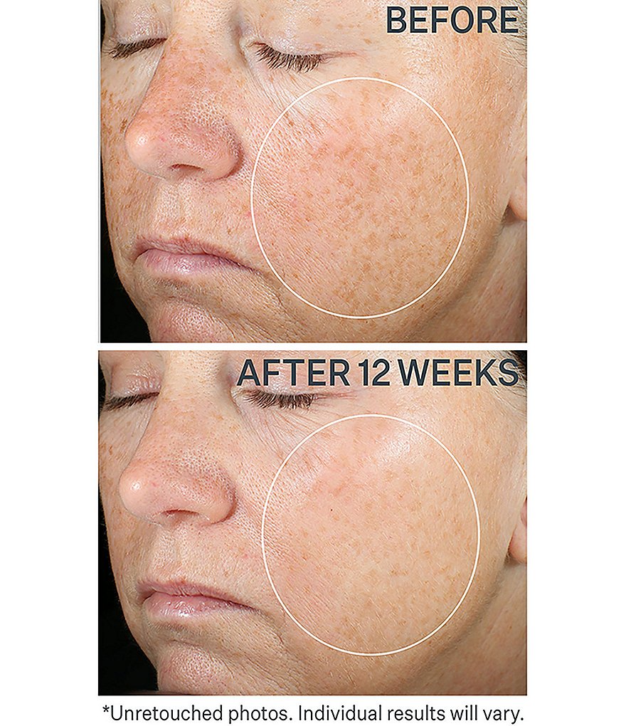 StriVectin SUPER-C RETINOL Brighten & Correct Vitamin C Serum