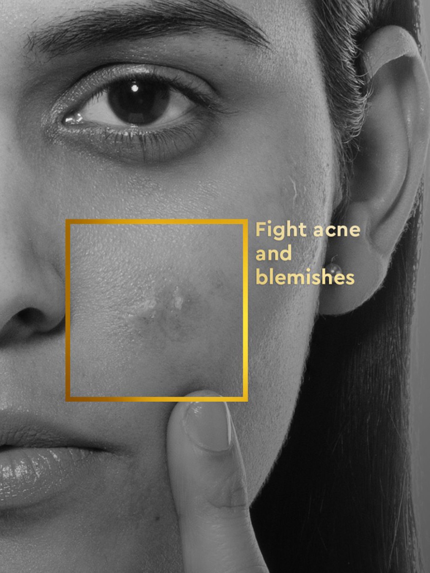 VLCC Clinic Anti Acne Face Wash & ProBright Macrofilm Clay Mask Combo