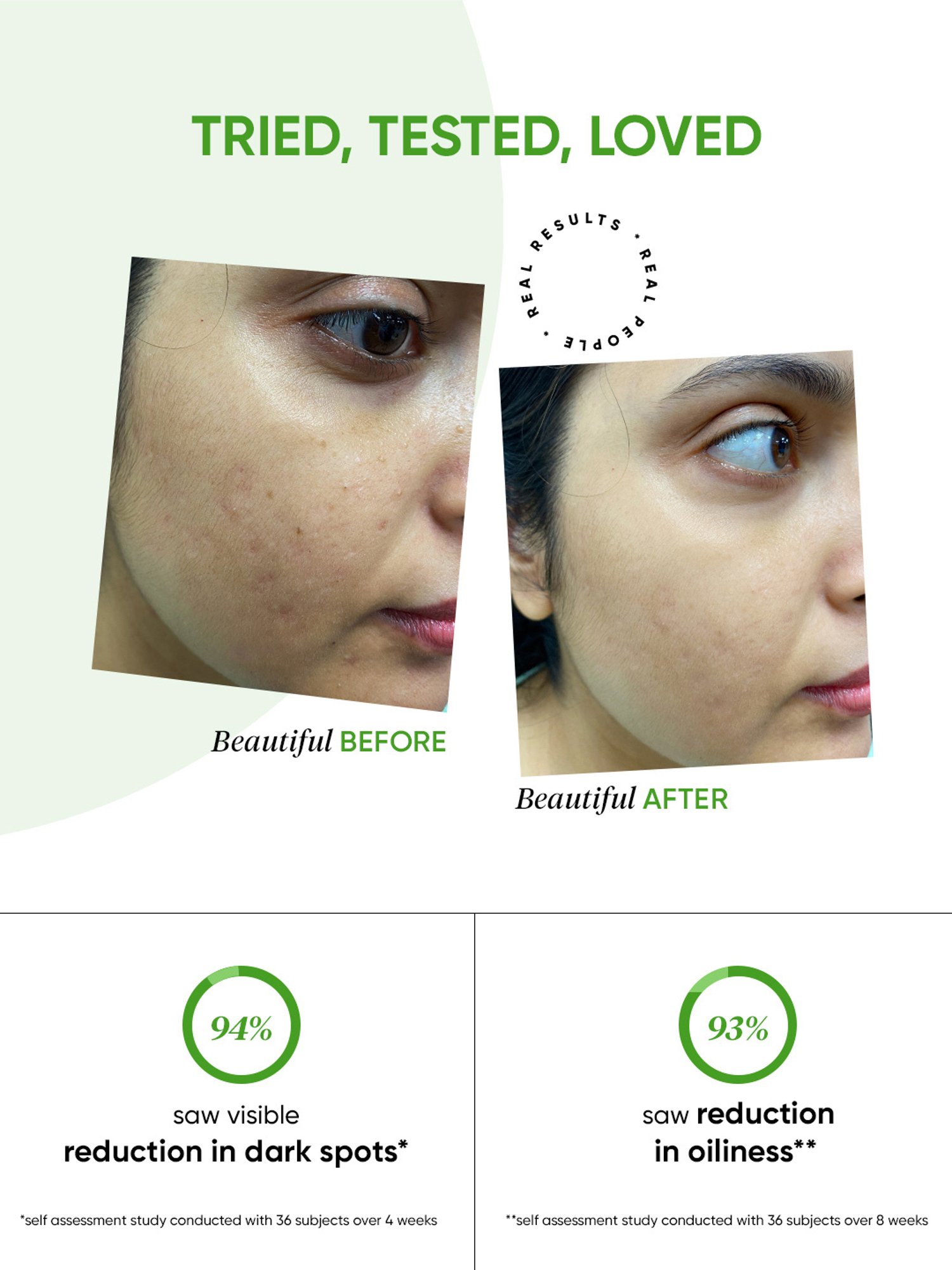 Dot & Key Ultimate Spotless Glow Face Serum - 20 ml