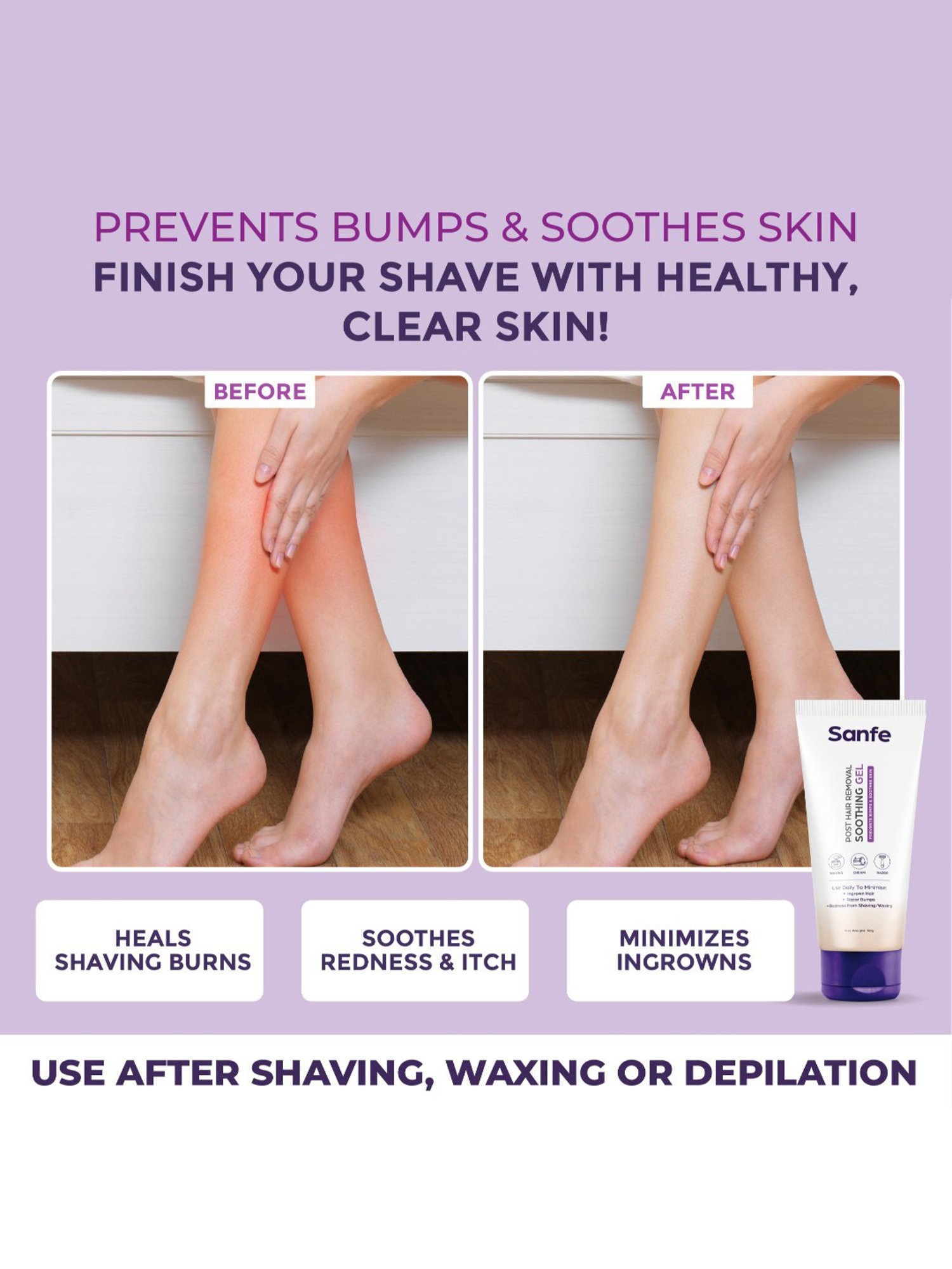 Sanfe Post Hair Removal Soothing Gel - 50 gm