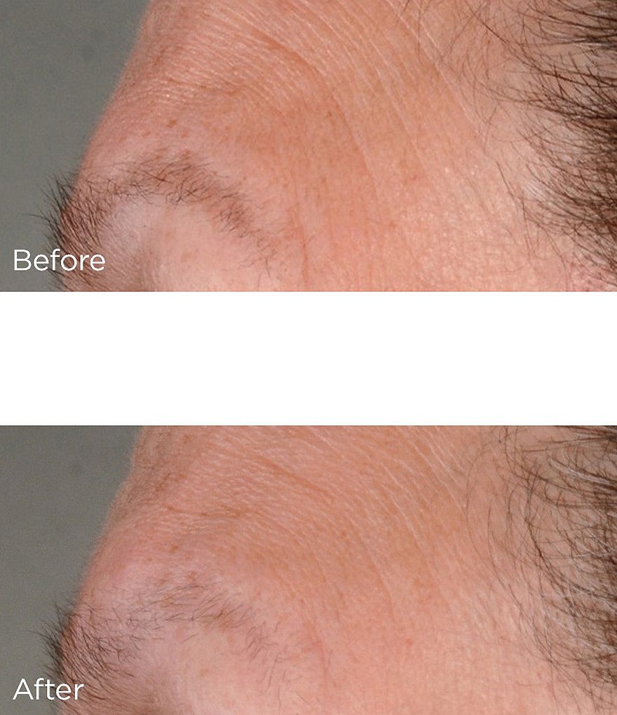 Perricone MD High Potency Classics Growth Factor Firming & Lifting Serum