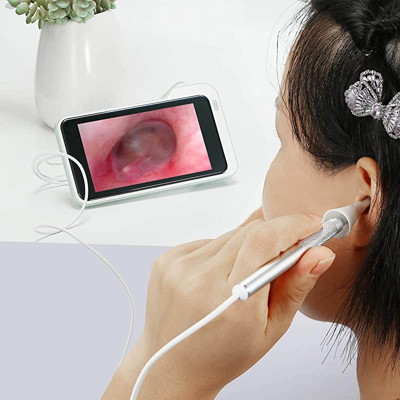 39mm Ear Inspection Camera with 5 inch IPS Screen Digital Otoscope with Earwax Removal Kit Tools Ear Scope Cleaning Tool